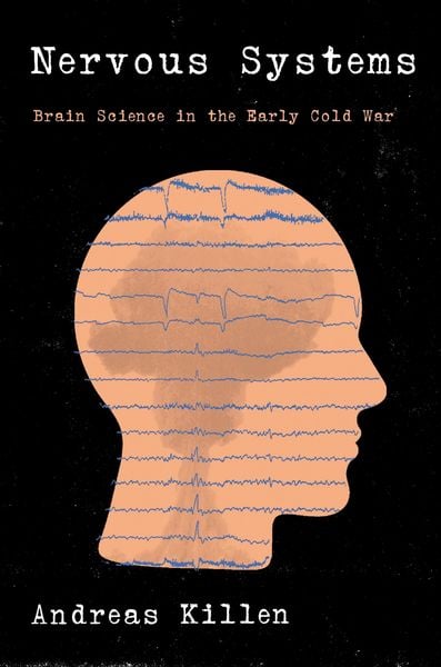 Produktbild: Killen, A: Nervous Systems
