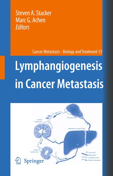 Produktbild: Lymphangiogenesis in Cancer Metastasis