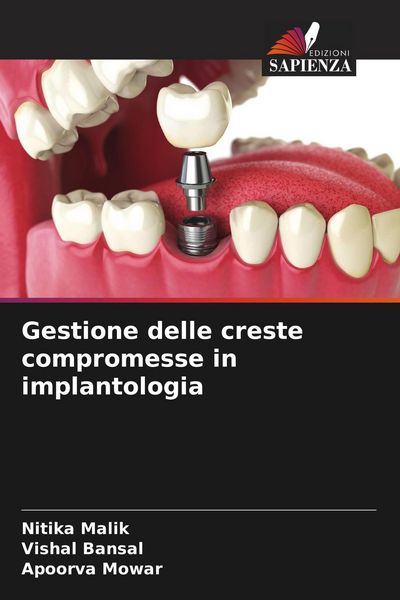 Produktbild: Gestione delle creste compromesse in implantologia