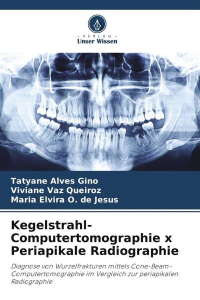 Produktbild: Kegelstrahl-Computertomographie x Periapikale Radiographie