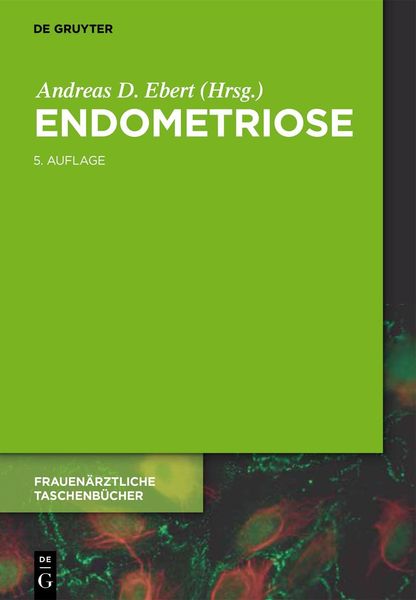 Produktbild: Endometriose