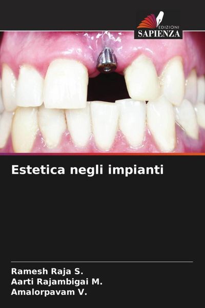 Produktbild: Estetica negli impianti