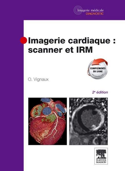 Produktbild: Imagerie Cardiaque : Scanner et Irm (2e Edition)