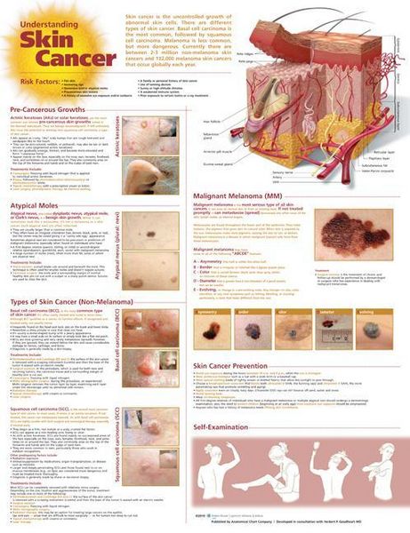 Produktbild: Understanding Skin Cancer Anat