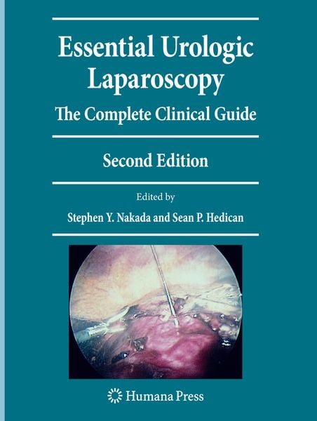 Produktbild: Essential Urologic Laparoscopy