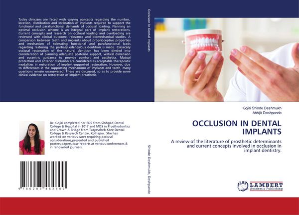 Produktbild: Occlusion in Dental Implants