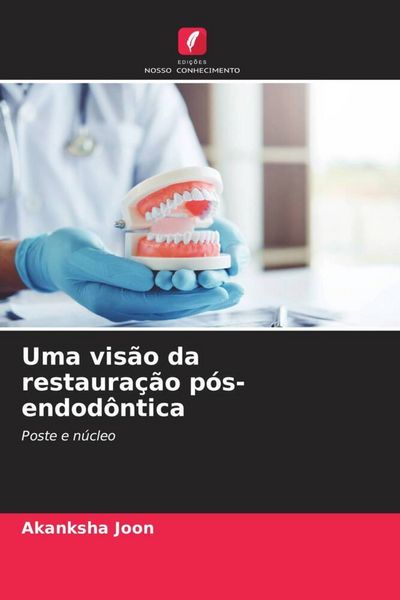 Produktbild: Uma vis&atilde;o da restaura&ccedil;&atilde;o p&oacute;s-endod&ocirc;ntica