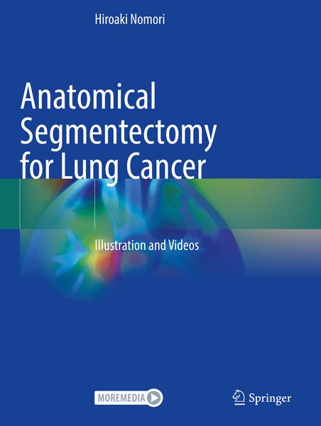 Produktbild: Anatomical Segmentectomy for Lung Cancer