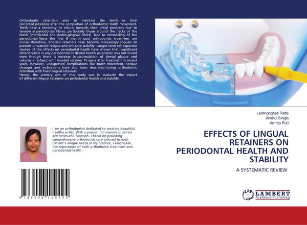 Produktbild: Effects Of Lingual Retainers On Periodontal Health and Stability