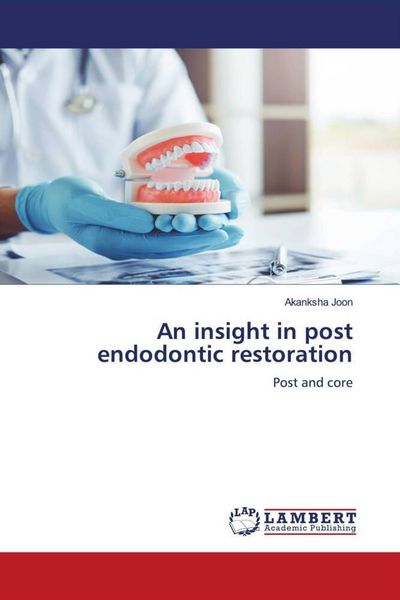 Produktbild: An insight in post endodontic restoration