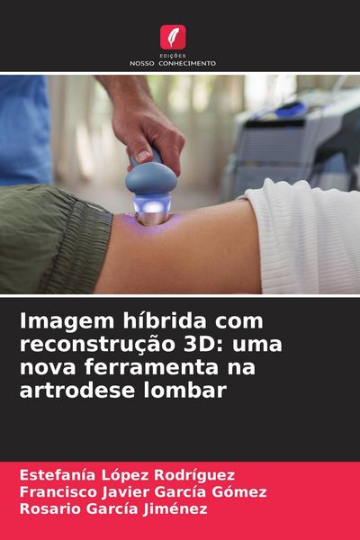 Produktbild: Imagem h&iacute;brida com reconstru&ccedil;&atilde;o 3D: uma nova ferramenta na artrodese lombar