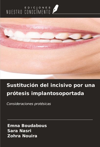 Produktbild: Sustituci&oacute;n del incisivo por una pr&oacute;tesis implantosoportada