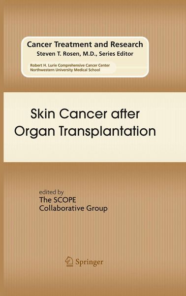 Produktbild: Skin Cancer after Organ Transplantation