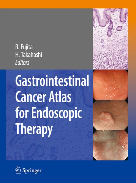 Produktbild: Gastrointestinal Cancer Atlas for Endoscopic Therapy