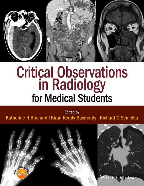 Produktbild: Critical Observations in Radiology for Medical Students