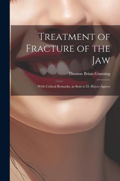 Produktbild: Treatment of Fracture of the Jaw; With Critical Remarks, as Sent to D. Hayes Agnew