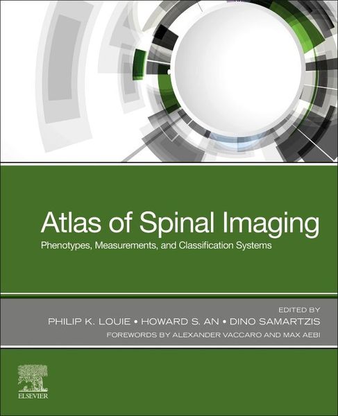 Produktbild: Atlas of Spinal Imaging