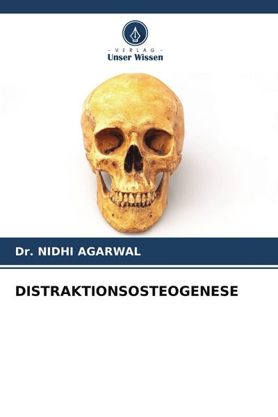 Produktbild: Distraktionsosteogenese