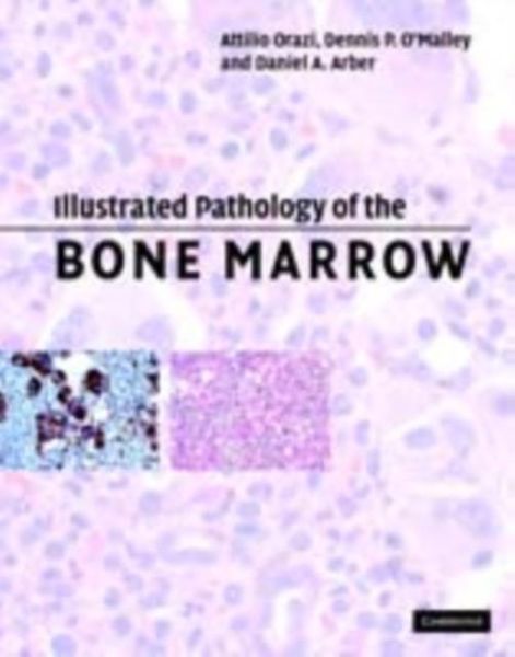 Produktbild: Illustrated Pathology of the Bone Marrow