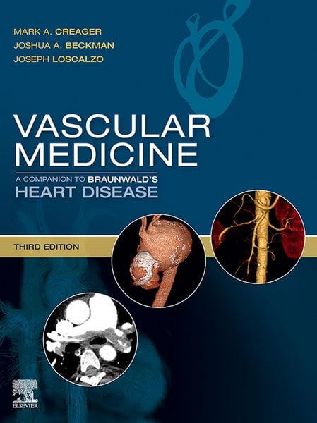 Produktbild: Vascular Medicine: A Companion to Braunwald's Heart Disease E-Book