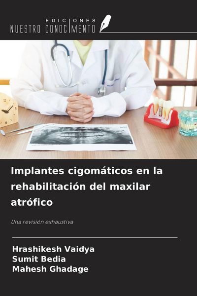 Produktbild: Implantes cigom&aacute;ticos en la rehabilitaci&oacute;n del maxilar atr&oacute;fico