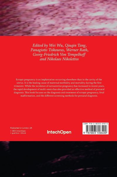 Produktbild: Ectopic Pregnancy and Prenatal Diagnosis