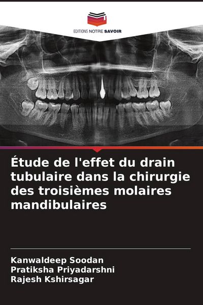 Produktbild: &Eacute;tude de l'effet du drain tubulaire dans la chirurgie des troisi&egrave;mes molaires mandibulaires