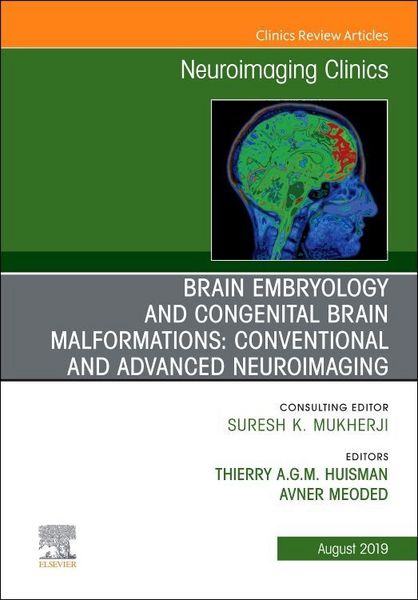 Produktbild: Brain Embryology and the Cause of Congenital Malformations, an Issue of Neuroimaging Clinics of North America