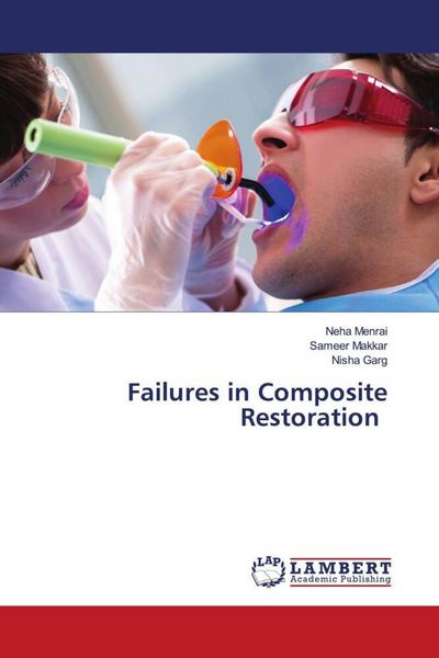 Produktbild: Failures in Composite Restoration