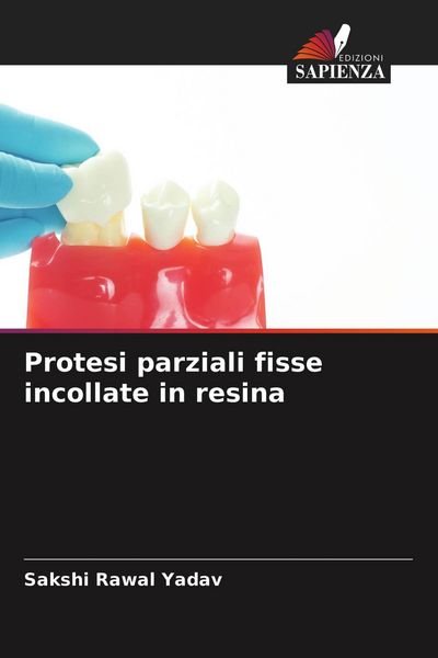 Produktbild: Protesi parziali fisse incollate in resina