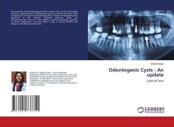 Produktbild: Odontogenic Cysts : An update