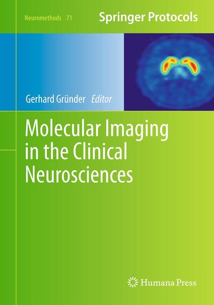 Produktbild: Molecular Imaging in the Clinical Neurosciences