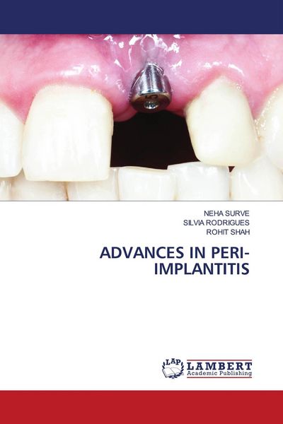 Produktbild: Advances in Peri-Implantitis