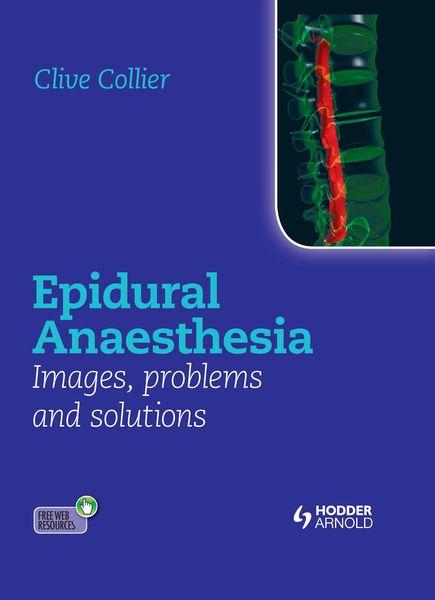 Produktbild: Epidural Anaesthesia: Images, Problems and Solutions