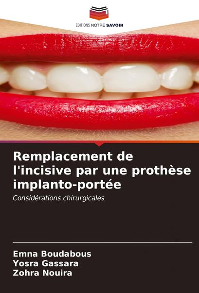 Produktbild: Remplacement de l'incisive par une proth&egrave;se implanto-port&eacute;e
