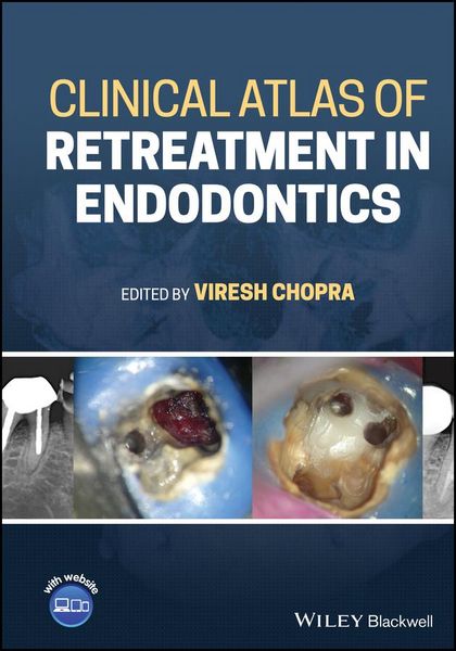Produktbild: Clinical Atlas of Retreatment in Endodontics