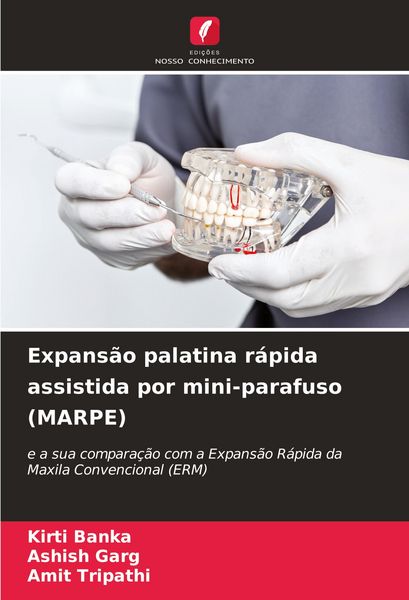 Produktbild: Expans&atilde;o palatina r&aacute;pida assistida por mini-parafuso (MARPE)