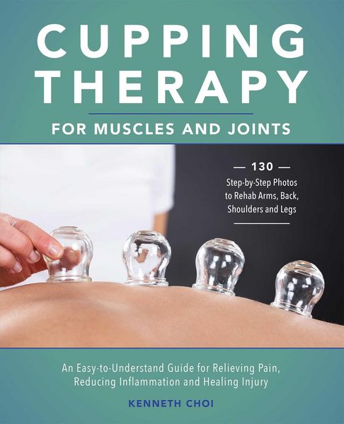 Produktbild: Cupping Therapy for Muscles and Joints