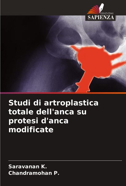 Produktbild: Studi di artroplastica totale dell'anca su protesi d'anca modificate