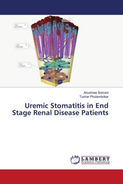 Produktbild: Uremic Stomatitis in End Stage Renal Disease Patients