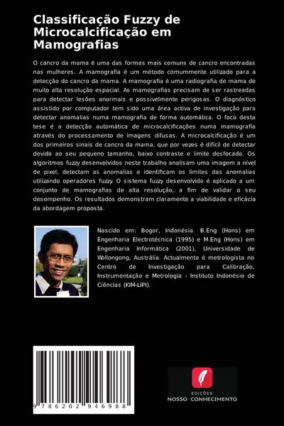 Produktbild: Classifica&ccedil;&atilde;o Fuzzy de Microcalcifica&ccedil;&atilde;o em Mamografias