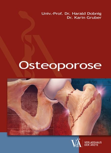 Produktbild: Osteoporose