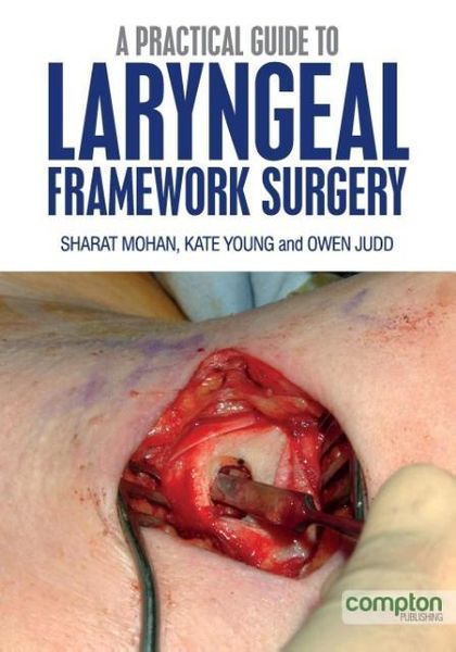 Produktbild: A Practical Guide to Laryngeal Framework Surgery