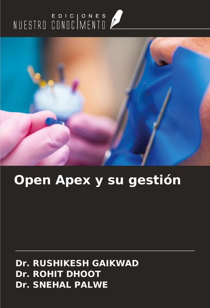 Produktbild: Open Apex y su gesti&oacute;n