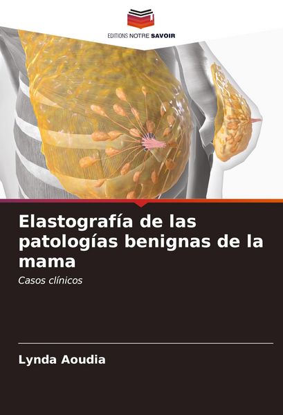 Produktbild: Elastograf&iacute;a de las patolog&iacute;as benignas de la mama