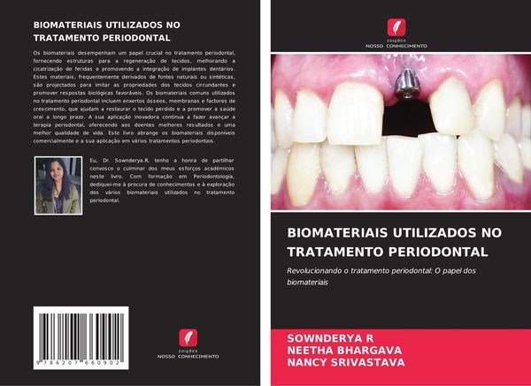 Produktbild: Biomateriais Utilizados No Tratamento Periodontal
