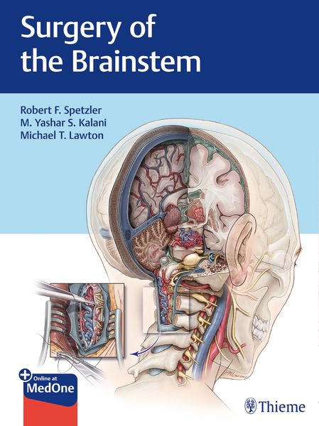 Produktbild: Surgery of the Brainstem