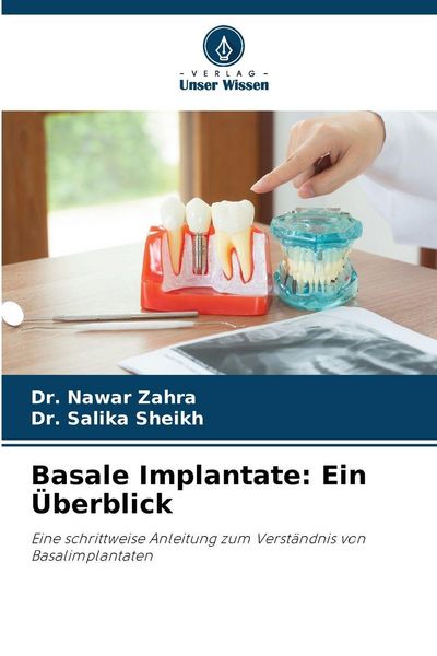 Basale Implantate: Ein Überblick, Taschenbuch von Nawar Zahra , Salika Sheikh, Verlag Unser Wissen, 9786208465858