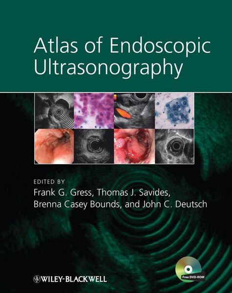 Produktbild: Atlas of Endoscopic Ultrasonography