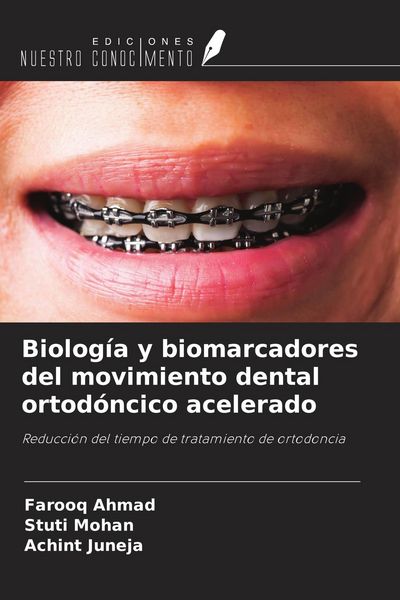 Produktbild: Biolog&iacute;a y biomarcadores del movimiento dental ortod&oacute;ncico acelerado